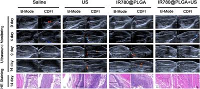 IR780 Based Sonotherapeutic Nanoparticles to Combat Multidrug-Resistant Bacterial Infections